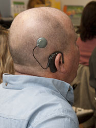 Man wearing cochlear implant