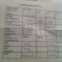 photo of audiogram results sheet