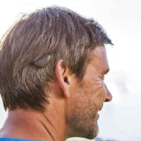 A man wearing a middle ear implant